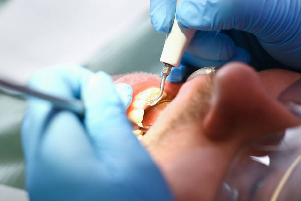 Best Emergency Dental Care for Abscessed Tooth in New Baden, IL